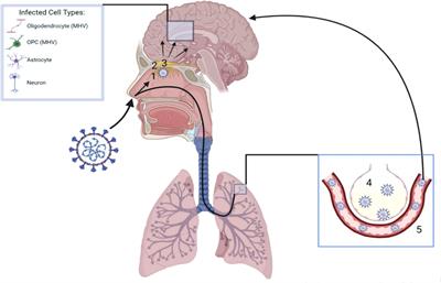SARS-CoV-2 and Multiple Sclerosis: Potential for Disease Exacerbation